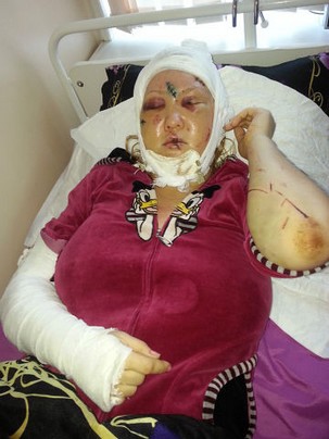 Мужчина жестоко избил бывшую сожительницу в Уссурийске